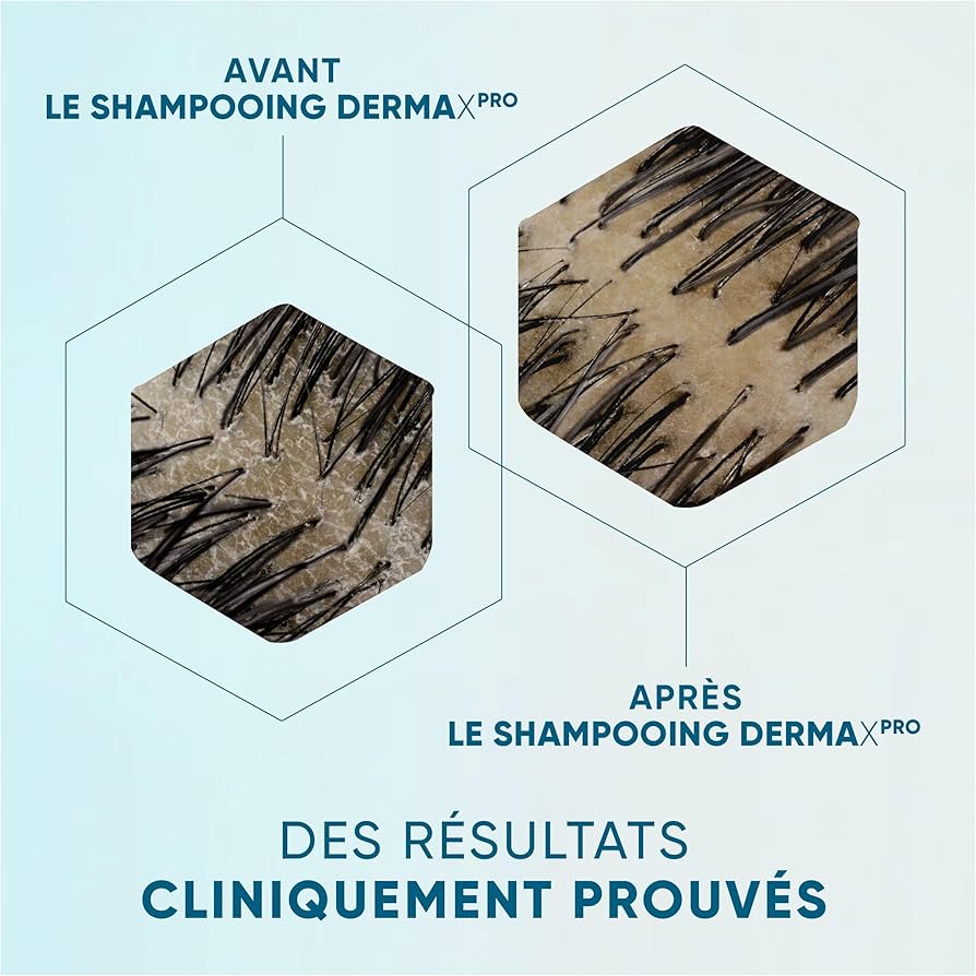 Head & Shoulders Shampoing À La Caféine Pour Cheveux Qui S'Affinent Et Cuir Chevelu Secs