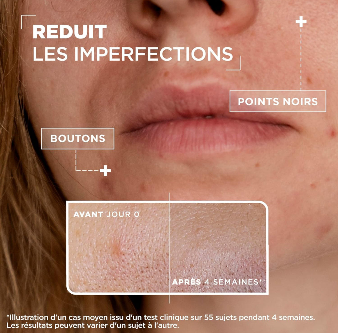 Mixa Sérum Concentré Anti-Taches - Pour Les Teints Ternes Enrichi En Vitamine C Et Acide Glycolique