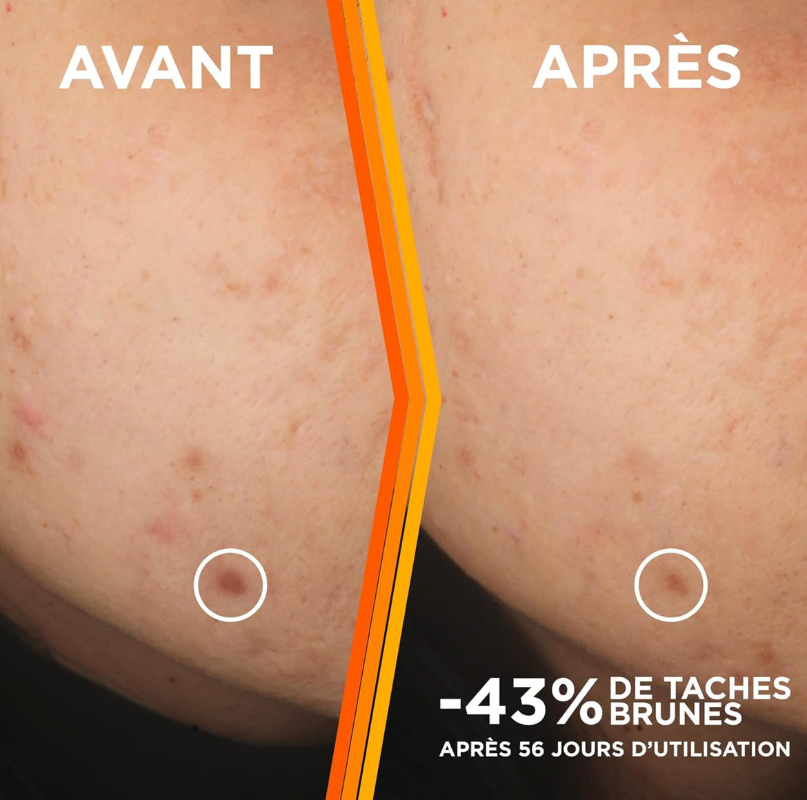 Garnier Skin Active Sérum Éclat Anti-Taches Enrichi En Vitamine C Acide Salicylique & Niacinamide