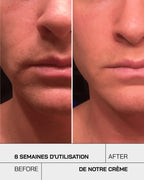 Touché Crème Hydratante Visage Hydratation Intense