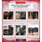 Bioxcin Shampoing Pour La Perte De Cheveux Forte - Pour Femme Et Homme