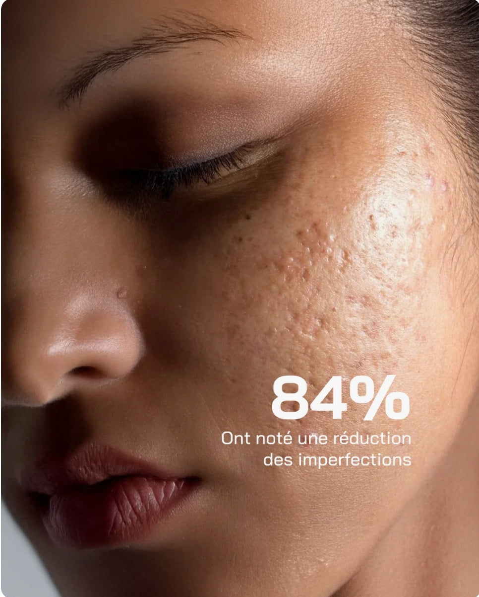 Touché Sérum Acide Salicylique 10% Anti-Imperfections
