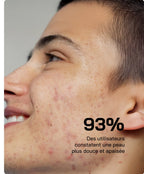 مصل حمض الساليسيليك Touché 10% مضاد للعيوب