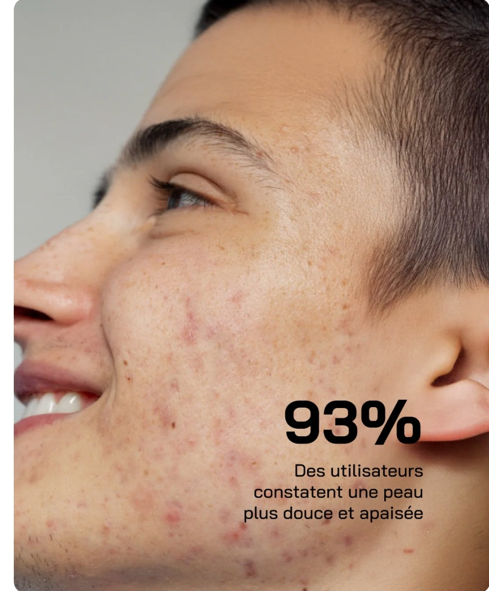 Touché Sérum Acide Salicylique 10% Anti-Imperfections