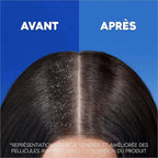 Head & Shoulders Après-Shampooing Intense Hydratation À L'Huile De Coco