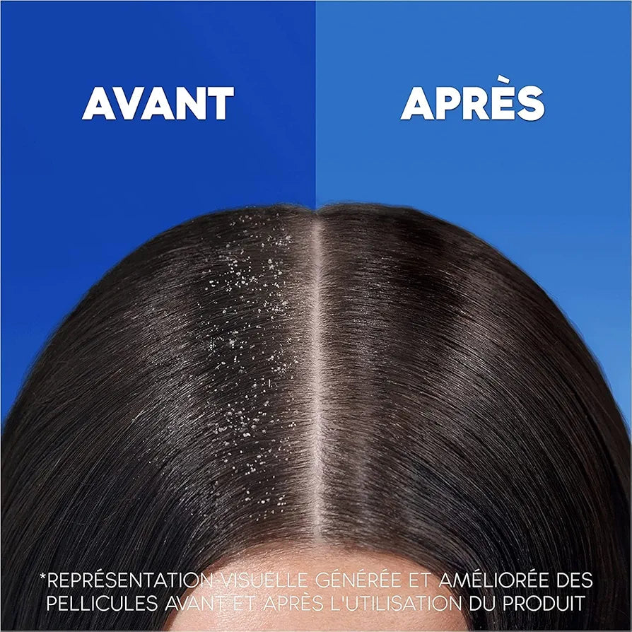 Head & Shoulders Après-Shampooing Intense Hydratation À L'Huile De Coco